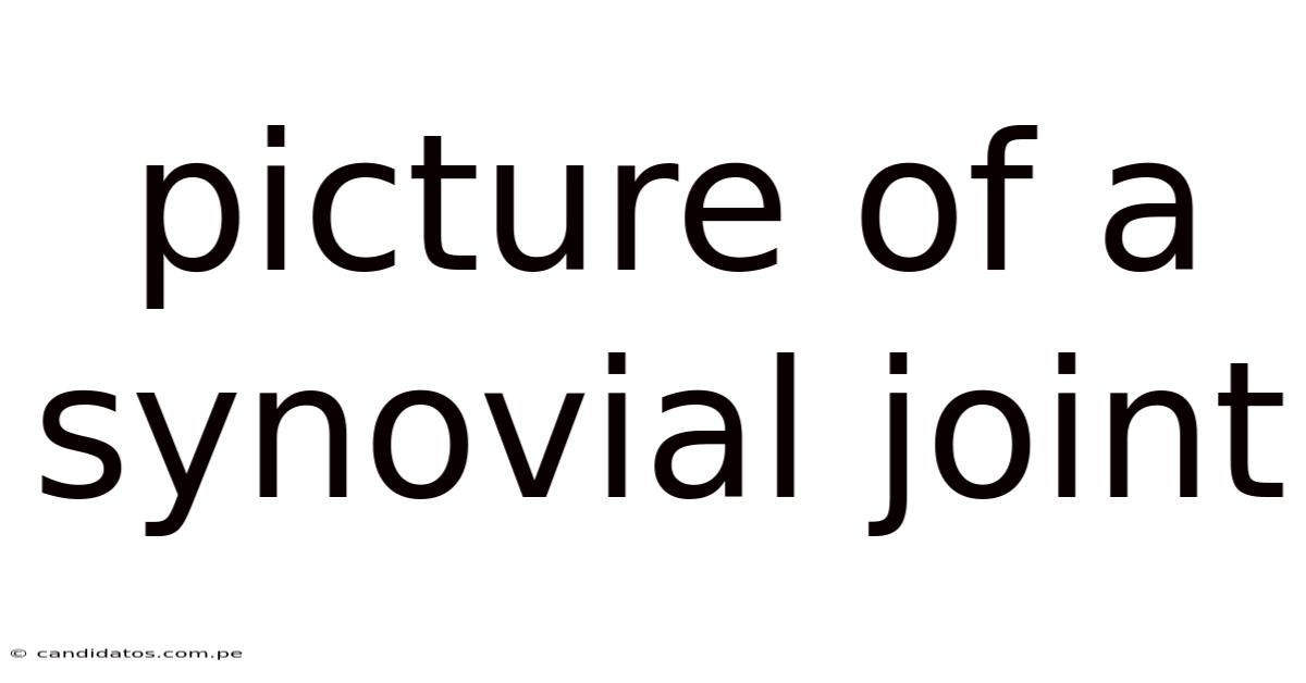 Picture Of A Synovial Joint